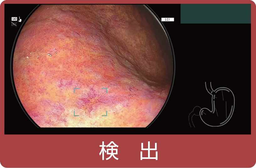 「CADEYE™」の特長