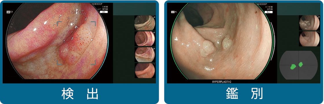 医師の判断を支える機能